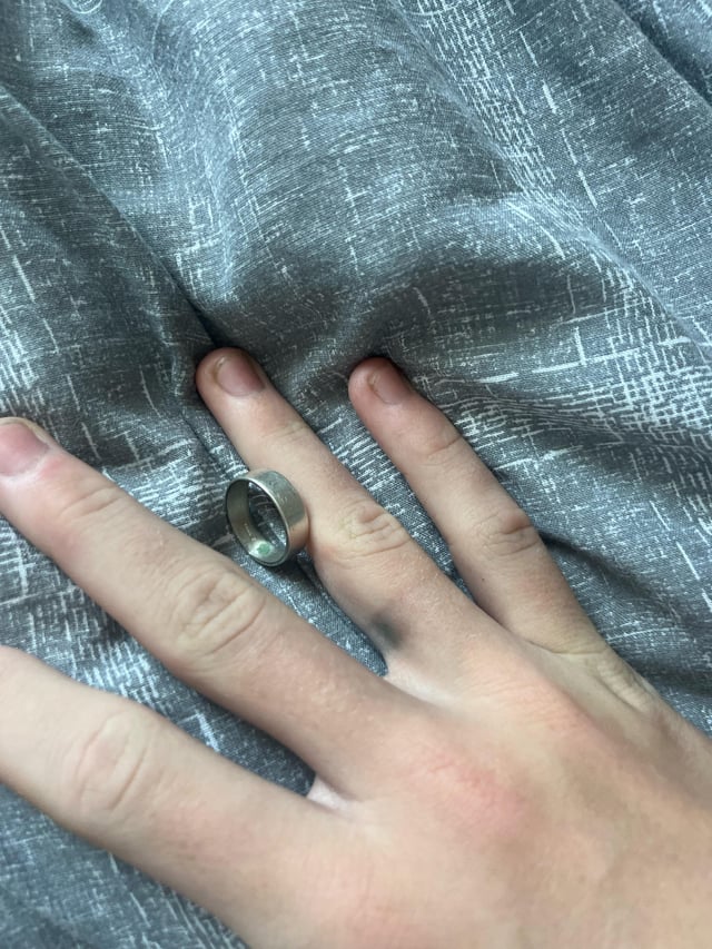 为什么我的手指开始变绿？