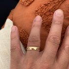 我的结婚戒指是不是太紧了？