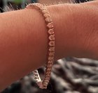 它会被控缩短此手镯吗？