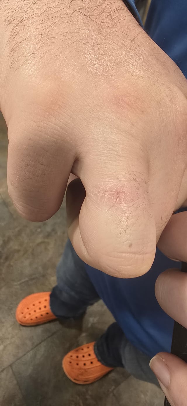 丈夫丈夫的手指