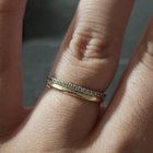 我的结婚戒指看起来太紧了吗？