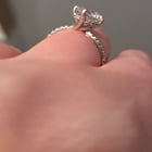 这是烧伤痕迹吗？