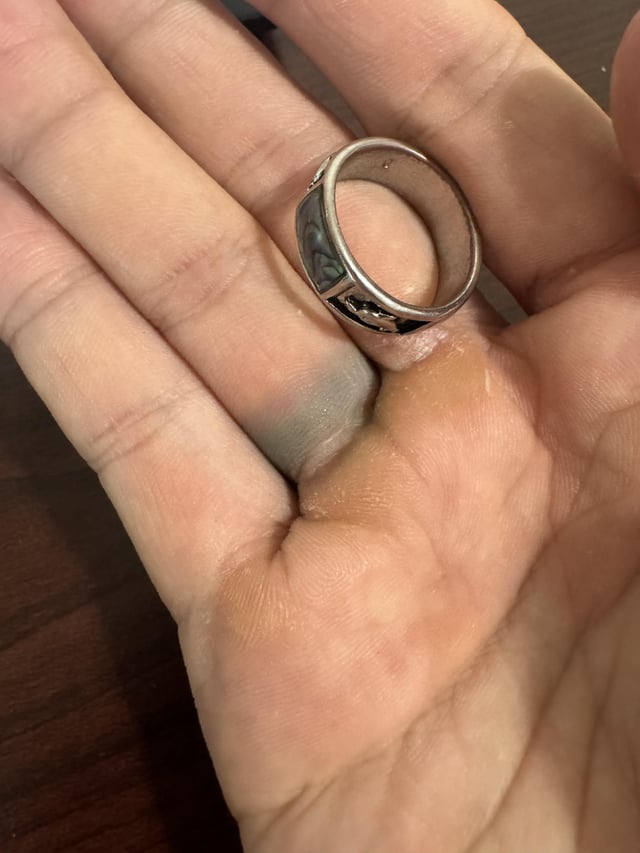 绿指转动戒指