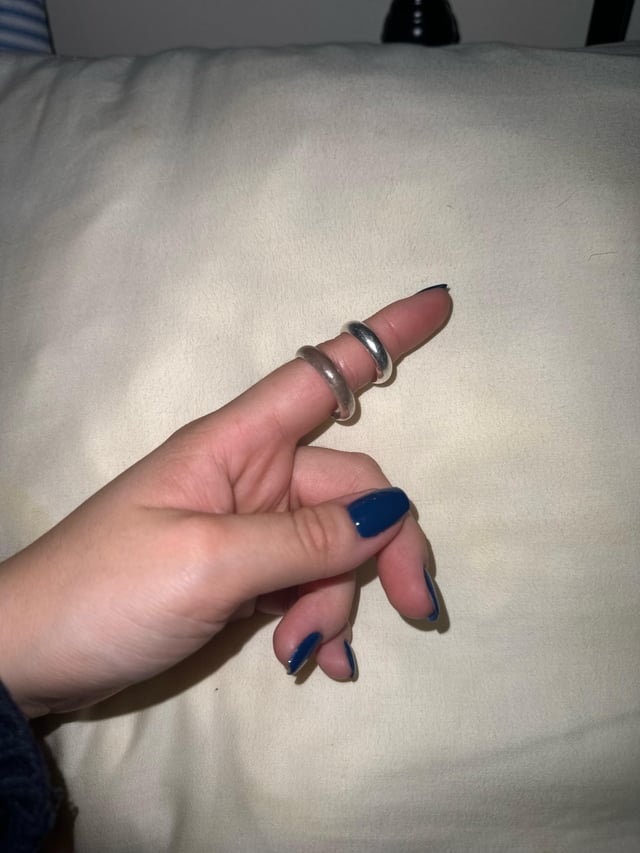 戒指变成棕色（？）