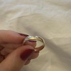 两天后新买的结婚戒指有黑点
